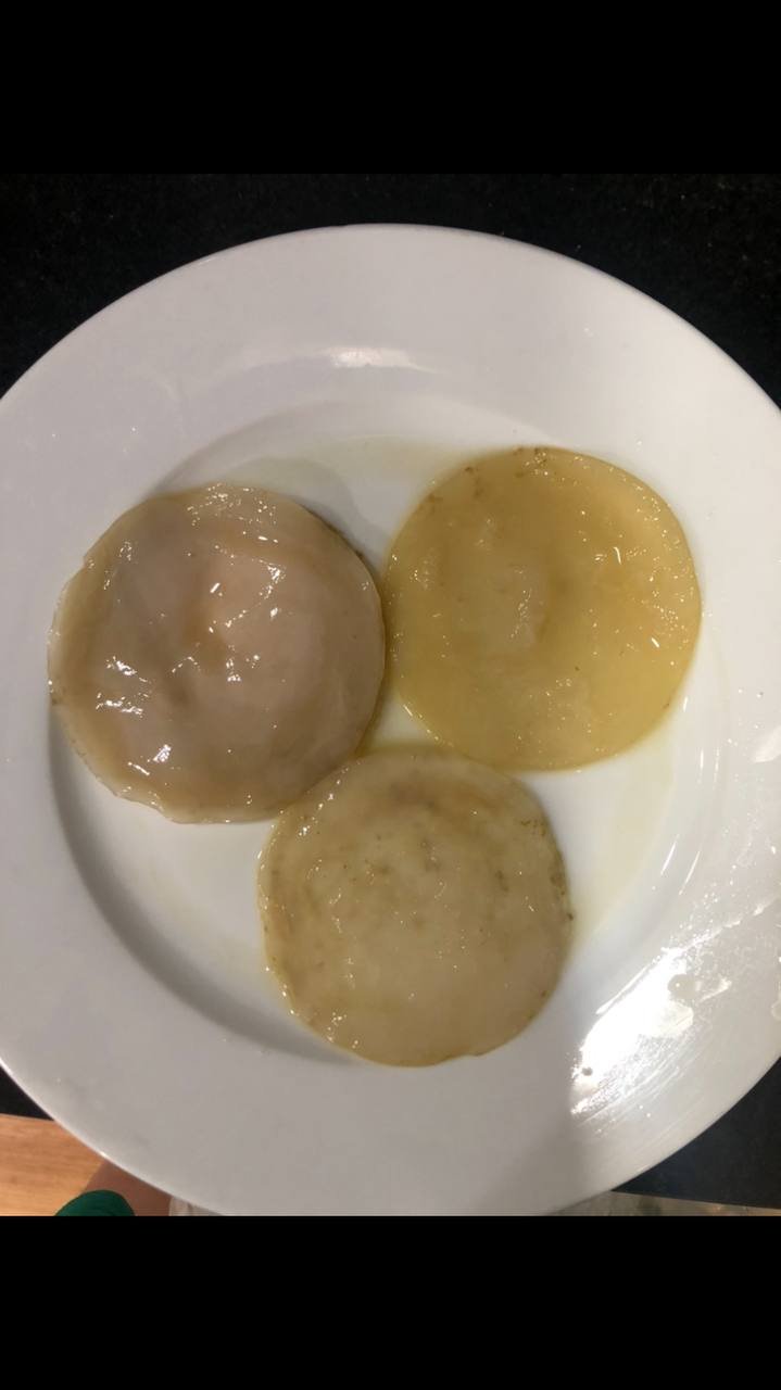 فطر الكومبوتشا (SCOBY) 50 ألف (البرطمان +20 ألف) — فيتنام